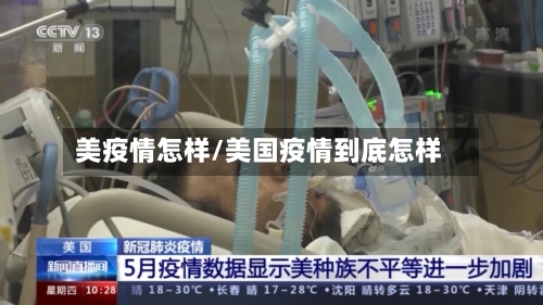 美疫情怎样/美国疫情到底怎样-第2张图片